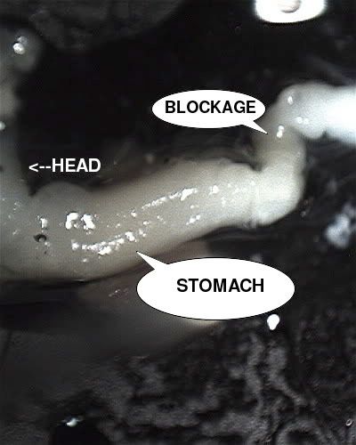 stomach1_phixr.jpg